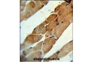 Formalin-fixed and paraffin-embedded human skeletal muscle reacted with TNFSF11 Antibody (N-term), which was peroxidase-conjugated to the secondary antibody, followed by DAB staining. (RANKL Antikörper  (N-Term))