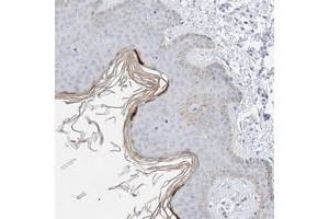 Immunohistochemical staining of human skin with KPRP polyclonal antibody  shows positivity in upper layer of epidermis at 1:200-1:500 dilution.