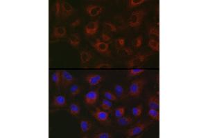 Immunofluorescence analysis of A-549 cells using GPLD1 Rabbit pAb (ABIN6131716, ABIN6141335, ABIN6141336 and ABIN6222300) at dilution of 1:50 (40x lens).
