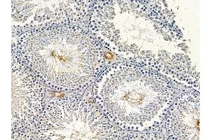 ABIN6264694 and ABIN6278626 at 1/100 staining rat testis tissue by IHC-P. (RELT Antikörper  (C-Term))