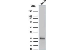 Western Blot Analysis of human brain tissue lysate using Pgp9. (UCHL1 Antikörper)