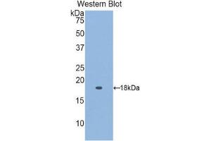 Western Blotting (WB) image for anti-Retinol Binding Protein 5, Cellular (RBP5) (AA 2-135) antibody (ABIN1860417) (Retinol Binding Protein 5 Antikörper  (AA 2-135))