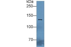 Western Blotting (WB) image for anti-Cadherin 1, Type 1, E-Cadherin (Epithelial) (CDH1) (AA 784-870) antibody (ABIN7430402)