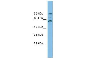 WB Suggested Anti-ANKRD5 Antibody Titration: 0. (ANKRD5 Antikörper  (N-Term))