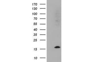 Image no. 1 for anti-Cystatin SA (CST2) antibody (ABIN1497758) (CST2 Antikörper)
