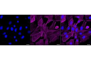 Immunocytochemical staining of H9c2 cells with PDLIM1 antibody (ABIN7799748), 1:1,000). (Rekombinanter PDLIM1 Antikörper)