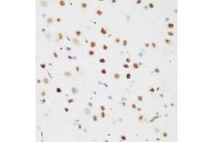 Immunohistochemistry of paraffin-embedded mouse brain using CSRNP1 antibody (ABIN5974288) at dilution of 1/200 (40x lens). (AXUD1 Antikörper)