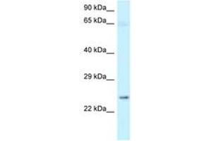 Image no. 1 for anti-Nicotinamide Nucleotide Adenylyltransferase 3 (NMNAT3) (N-Term) antibody (ABIN6747979) (NMNAT3 Antikörper  (N-Term))