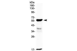 Western blot testing of rat small intestine lysate with GALNS antibody at 0. (GALNS Antikörper)