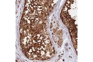 Immunohistochemical staining of human testis with CABP5 polyclonal antibody  shows strong cytoplasmic positivity in cells in seminiferus ducts.