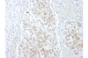 Immunohistochemistry (IHC) image for anti-Eukaryotic Translation Initiation Factor 4E Binding Protein 1 (EIF4EBP1) (C-Term) antibody (ABIN7448395)