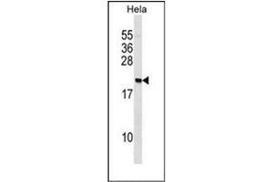 Western blot analysis of PAIP2 Antibody (N-term) in Hela cell line lysates (35ug/lane).