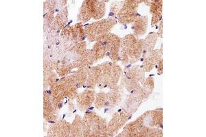 Immunohistochemical analysis of paraffin-embedded H. (SDHA Antikörper  (C-Term))