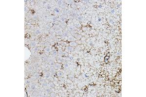 Immunohistochemistry of paraffin-embedded rat brain using CHAT Rabbit pAb (ABIN3016134, ABIN3016135, ABIN3016136 and ABIN6219569) at dilution of 1:50 (40x lens). (Choline Acetyltransferase Antikörper  (AA 331-630))