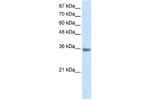 WB Suggested Anti-MNAT1 Antibody Titration:  1. (MNAT1 Antikörper  (C-Term))