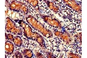 Immunohistochemistry of paraffin-embedded human small intestine tissue using ABIN7170381 at dilution of 1:100 (SNX27 Antikörper  (AA 458-497))