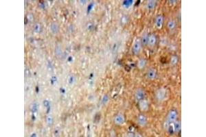 IHC-P analysis of Brain tissue, with DAB staining. (FIL1d Antikörper  (AA 12-151))