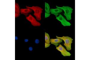 ABIN7095361 and ABIN7099418 staining Hela cells by IF/ICC. (ORMDL3 Antikörper)