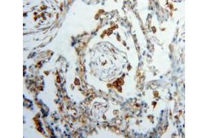 Used in DAB staining on fromalin fixed paraffin-embedded lung tissue (Vimentin Antikörper  (AA 2-466))