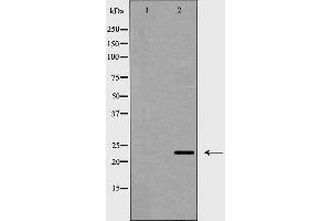 Western blot analysis of CD83 expression in HeLa cells,The lane on the left is treated with the antigen-specific peptide. (CD83 Antikörper  (Internal Region))