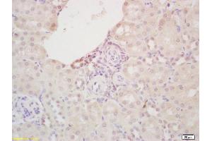 Immunohistochemistry (IHC) image for anti-Fatty Acid Binding Protein 3, Muscle and Heart (FABP3) (AA 8-100) antibody (ABIN1387630)