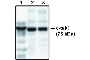 Western blot analysis using c-tak1 antibody . (TR4 Antikörper)