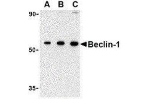 Western Blotting (WB) image for anti-Beclin 1, Autophagy Related (BECN1) (N-Term) antibody (ABIN2477609) (Beclin 1 Antikörper  (N-Term))