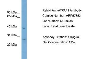 WB Suggested Anti-ATPAF1  Antibody Titration: 0. (ATPAF1 Antikörper  (Middle Region))