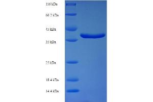 SDS-PAGE (SDS) image for 5,10-Methenyltetrahydrofolate Synthetase (5-Formyltetrahydrofolate Cyclo-Ligase) (MTHFS) (AA 2-203) protein (His-SUMO Tag) (ABIN5709975)