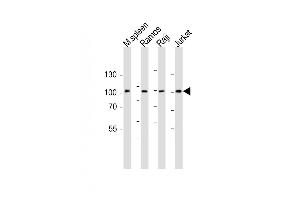 All lanes : Anti-BCL6 Antibody (Center) at 1:1000 dilution Lane 1: mouse spleen lysate Lane 2: Ramos whole cell lysate Lane 3: Raji whole cell lysate Lane 4: Jurkat whole cell lysate Lysates/proteins at 20 μg per lane. (BCL6 Antikörper  (AA 364-395))