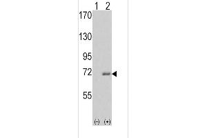 Western blot analysis of IRAK1 (arrow) using rabbit polyclonal IRAK Antibody (C-term) . (IRAK1 Antikörper  (C-Term))