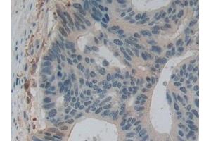 Immunohistochemistry (IHC) image for anti-Gelsolin (GSN) (AA 577-771) antibody (ABIN7442030)
