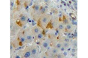 Used in DAB staining on fromalin fixed paraffin-embedded Liver tissue (LILRB3 Antikörper  (AA 410-631))