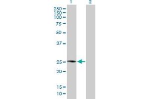 Western Blot analysis of PLA2G4D expression in transfected 293T cell line by PLA2G4D MaxPab polyclonal antibody. (PLA2G4D Antikörper  (AA 1-216))