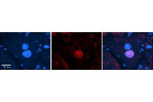 Rabbit Anti-NR5A1 Antibody  Catalog Number: ARP45620_P050 Formalin Fixed Paraffin Embedded Tissue: Human Adult heart  Observed Staining: Nuclear and some weak cytoplasmic Primary Antibody Concentration: 1:600 Secondary Antibody: Donkey anti-Rabbit-Cy2/3 Secondary Antibody Concentration: 1:200 Magnification: 20X Exposure Time: 0.
