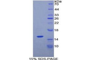 SDS-PAGE analysis of Human PLAA Protein. (PLAA Protein)