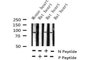 Western blot analysis of Phospho-ATRIP (Ser68) expression in various lysates (ATRIP Antikörper  (pSer68))