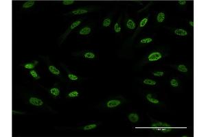 Immunofluorescence of monoclonal antibody to FOS on HeLa cell. (c-FOS Antikörper  (AA 1-100))