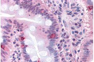 Human Small Intestine: Formalin-Fixed, Paraffin-Embedded (FFPE) (SEMA4B Antikörper  (Internal Region))
