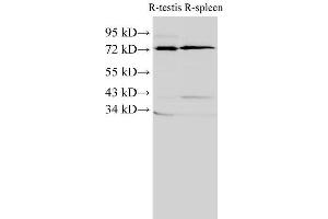 Western Blot analysis of Rat testis and Rat spleen using ANXA6 Polyclonal Antibody at dilution of 1:2000 (ANXA6 Antikörper)