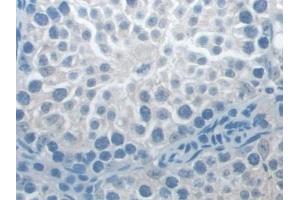 Immunohistochemistry (IHC) image for anti-NLR Family, Pyrin Domain Containing 3 (NLRP3) (AA 671-1033) antibody (ABIN7443710)
