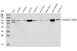 Western blot analysis of CD64/FCGR1A using anti-CD64/FCGR1A antibody (ABIN7600432).