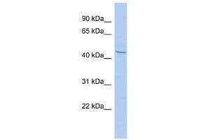 Western Blot showing ZBTB12 antibody used at a concentration of 1-2 ug/ml to detect its target protein.