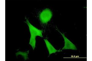 Immunofluorescence of monoclonal antibody to GAS2 on NIH/3T3 cell. (GAS2 Antikörper  (AA 1-110))