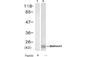 Image no. 2 for anti-Stathmin 1 (STMN1) (Ser62) antibody (ABIN319391) (Stathmin 1 Antikörper  (Ser62))