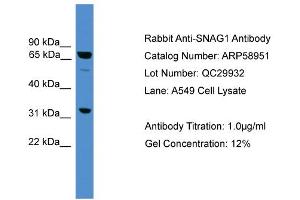 WB Suggested Anti-SNAG1  Antibody Titration: 0.
