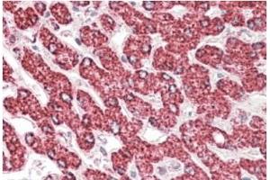AP21283PU-N ETFB antibody staining paraffin embedded Human Liver at 3. (ETFB Antikörper  (Internal Region))