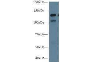 Rabbit Capture antibody from the kit in WB with Positive Control: Sample Human Hela cell lysate;. (MGEA5 ELISA Kit)