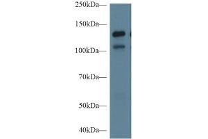 Rabbit Capture antibody from the kit in WB with Positive Control: Sample Human Hela cell lysate;. (MGEA5 ELISA Kit)