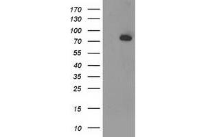 HEK293T cells were transfected with the pCMV6-ENTRY control (Left lane) or pCMV6-ENTRY ACSS2 (Right lane) cDNA for 48 hrs and lysed. (ACSS2 Antikörper)